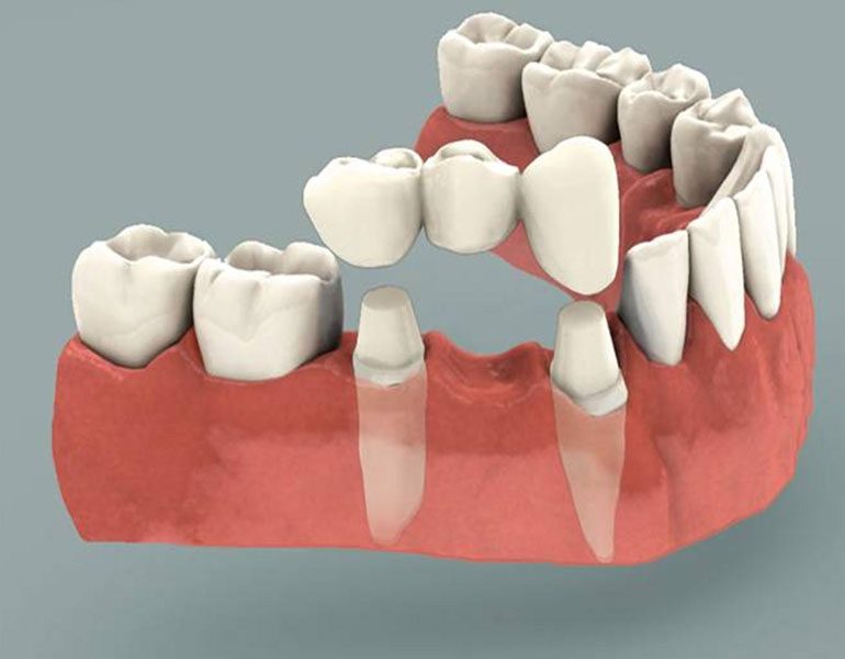 dental hospital paravur