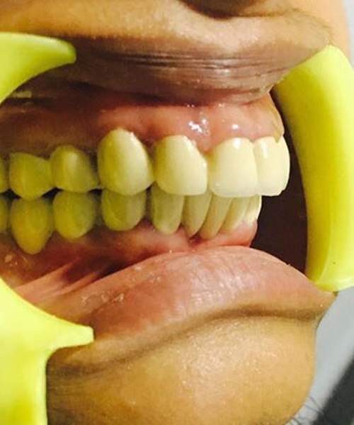 dental clinic paravur